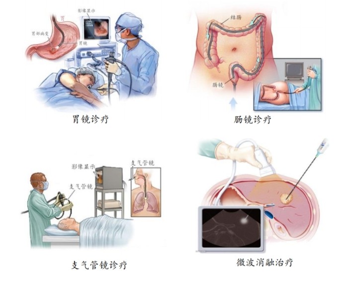 醫用內窺鏡介紹