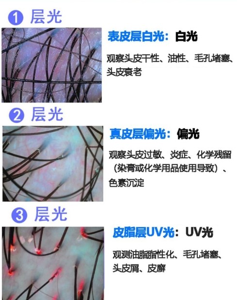 不同光對頭發(fā)的觀(guān)測效果